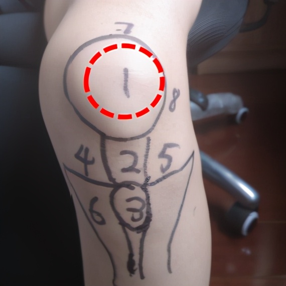 不同膝盖疼痛是暗示什么,不同位置的膝盖疼