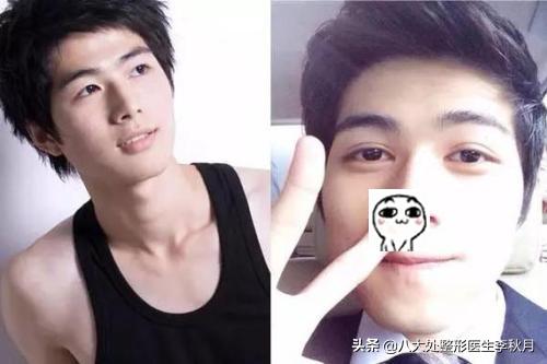 哪些男女明星双眼皮是割的,娱乐圈双眼皮男明星