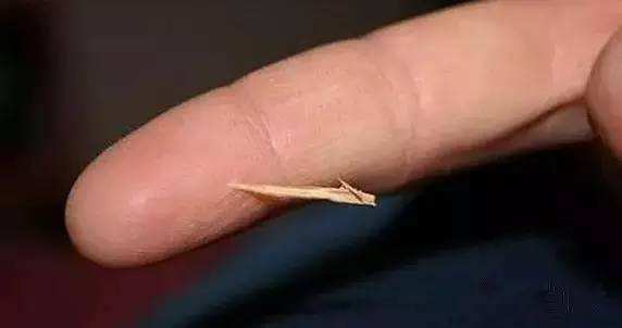 木刺扎到手指急救妙招,不小心把刺戳进手指里怎么办