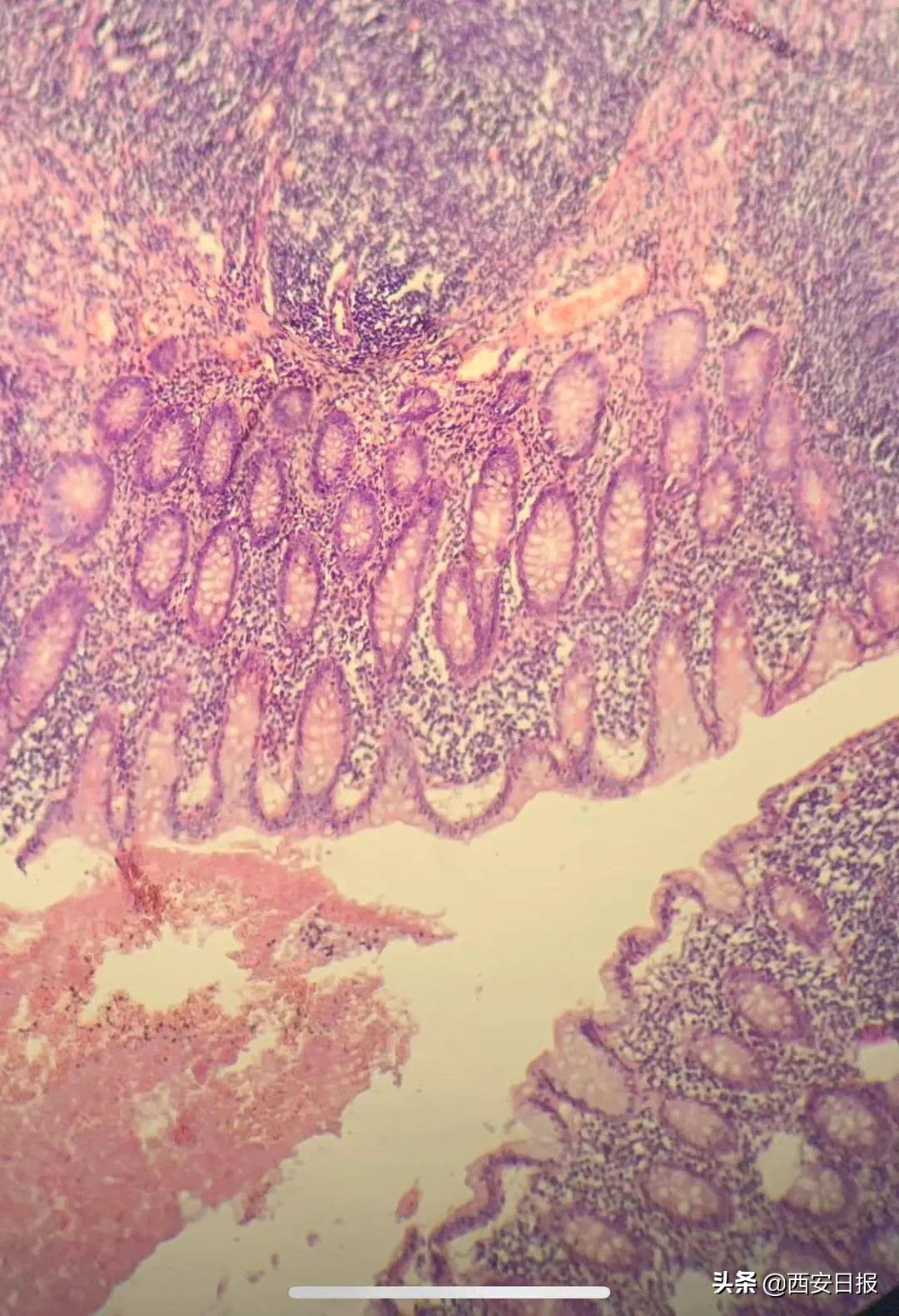 病理学切片染色,病理技术常规切片染色