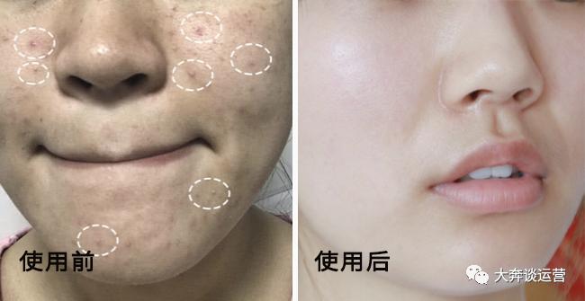 大牌洗面奶哪款好用排行榜最新版,洗面奶到底哪款好用又实惠