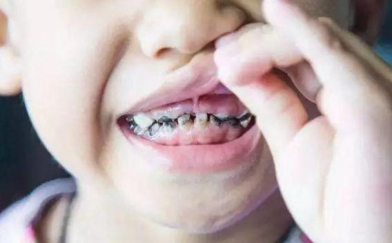 宝宝每天吃糖的危害,宝宝大量吃糖的危害