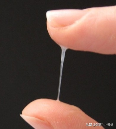 妇检多久一次,妇检多久检查一次合适