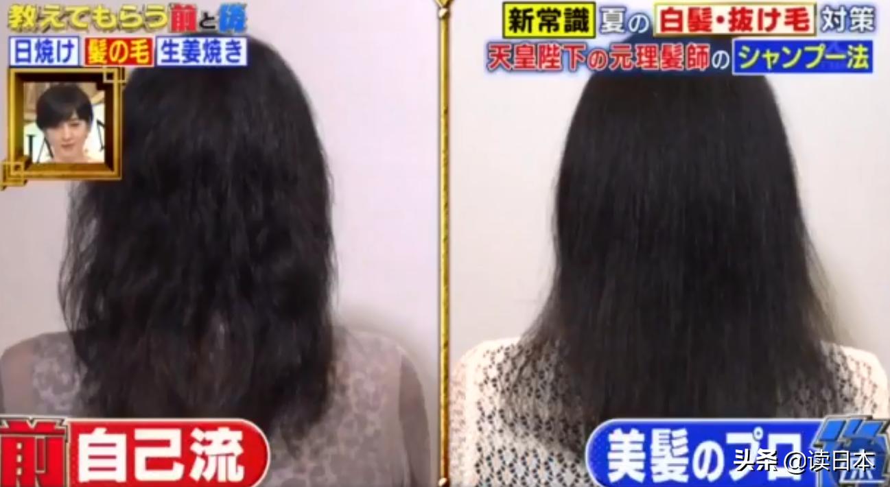 日本防止脱发的方法,日本最新治疗脱发技术