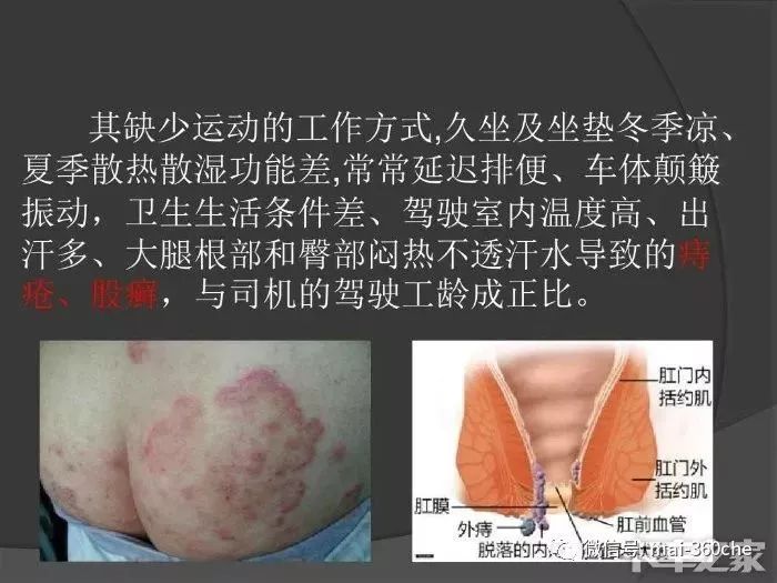 防止屁屁变黑的坐垫,能让屁屁翘的坐垫