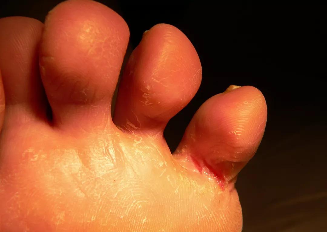 袜子裤子能不能一起洗,袜子与裤子可以一起泡不