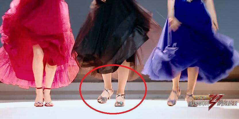 腿粗是因为内脏有问题吗,腿粗是不是因为骨头粗