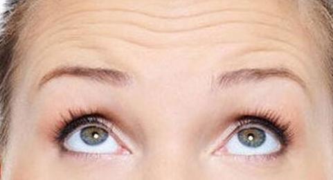 抬头纹鱼尾纹法令纹哪个更显老,抬头纹鱼尾纹法令纹颈纹一样没少