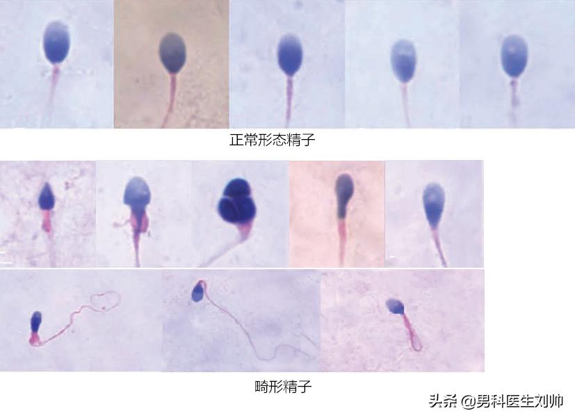 男性健康科普检测,男科检查科普视频