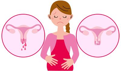 试管打达菲林有褐色血,试管前打完达菲林20天出血了