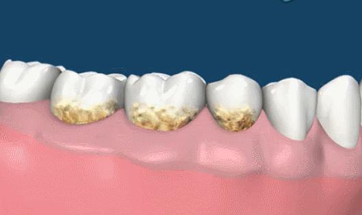 李湘贵妇,李湘美白牙膏