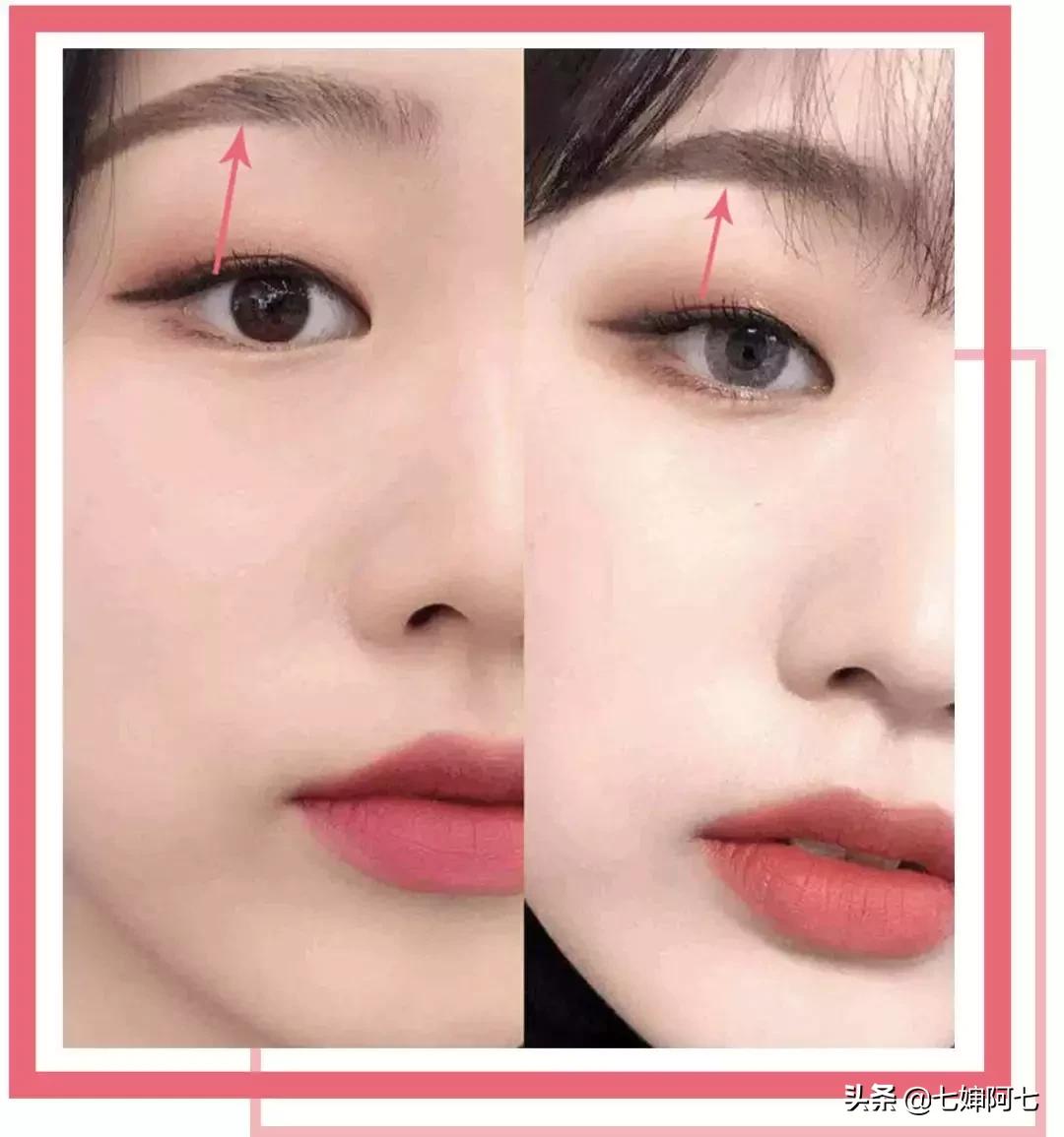 快速消肿肿眼泡,快速拯救眼睛黑眼圈