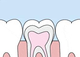 儿童蛀牙补牙要补几次,4岁孩子蛀牙补牙视频