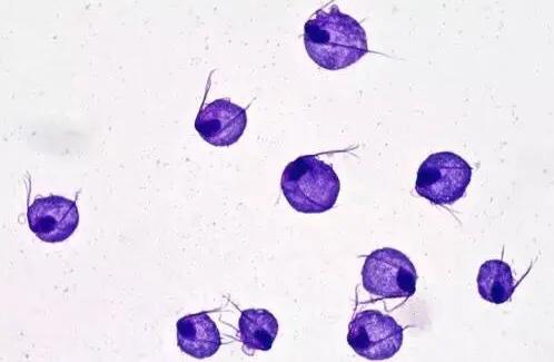 白带异常外阴瘙痒腰骶疼痛,白带多外阴瘙痒肿疼怎么回事