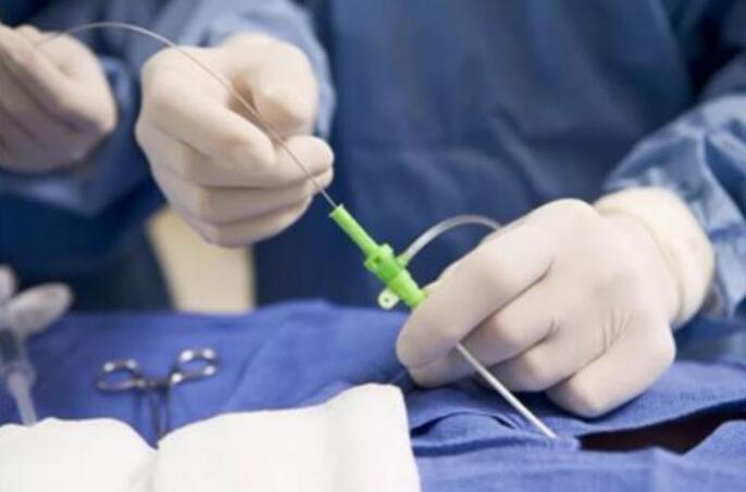 什么是冷冻消融术,三甲医院为什么没有冷冻消融技术