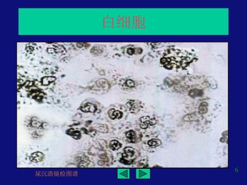 体检发现尿潜血怎么办？别担心，三步帮你解决问题！