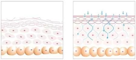 护肤品成分噱头,护肤成分透明质酸你了解多少