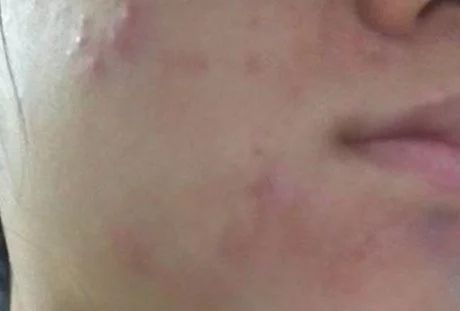 堪比科颜氏白泥的其他护肤品,堪比科颜氏精华