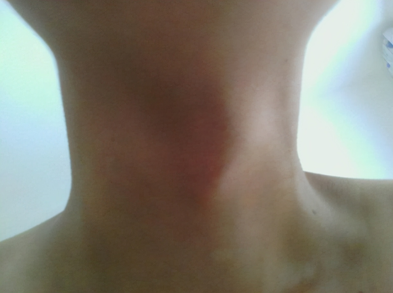 男生喉结看不出来怎么回事,关于男生喉结不能摸的小视频