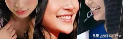 为什么侧颜没有下巴轮廓,侧颜怎么p下巴