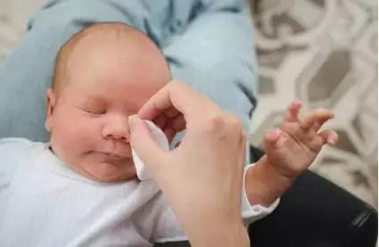 宝宝眼屎多真的是上火么原版,宝宝眼屎多是不是生病了