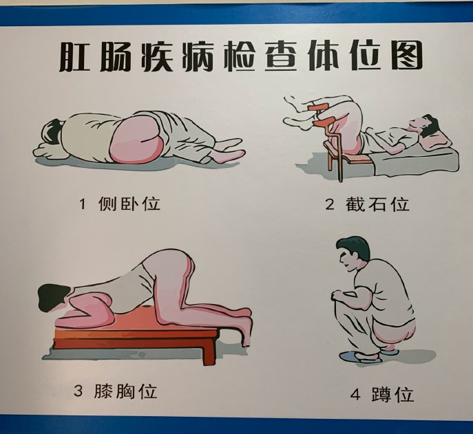 中国体检,体检一般都会有哪些小问题