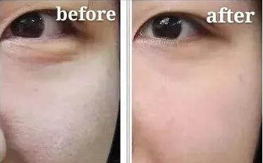 为什么有些人年纪不大，但法令纹却很重？