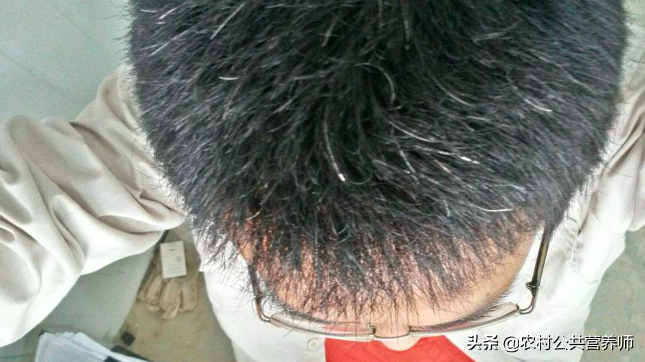 中年人头发乌黑浓密,头发乌黑的中年人