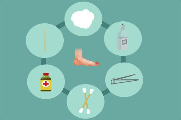 脚趾甲长到肉里面的修剪视频,脚趾甲长到肉里面很痛怎么办