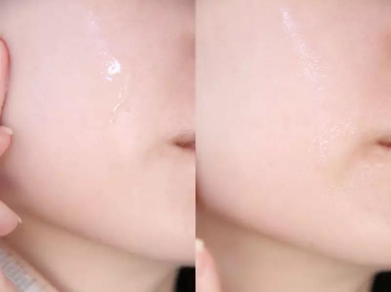 2块钱的它、竟然能亮白、祛痘印、淡斑！？太神奇了！