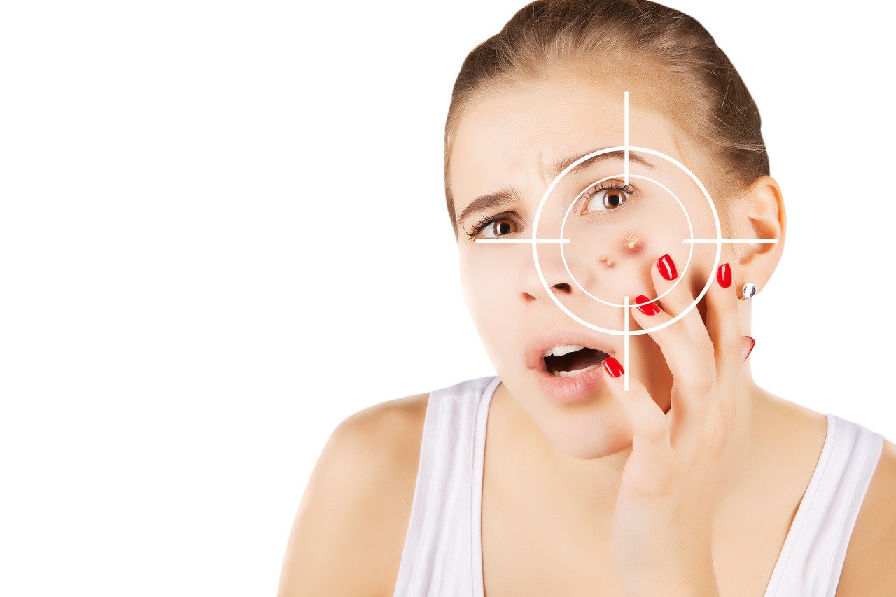 痘痘越长越厉害是怎么回事,痘痘越长越多是怎么回事