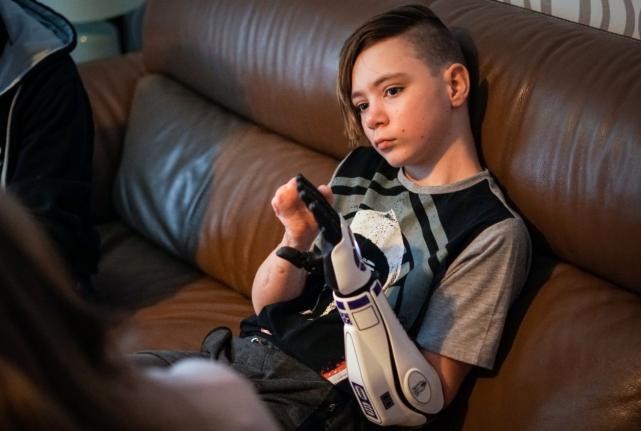 没有双臂的美国男孩获得假肢,失去双臂男孩考上剑桥大学