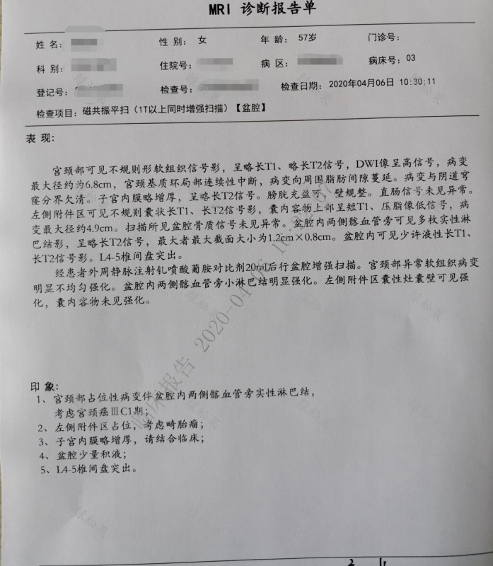 57岁绝经后出血是什么原因,绝经后尿频尿急出血是不是宫颈癌