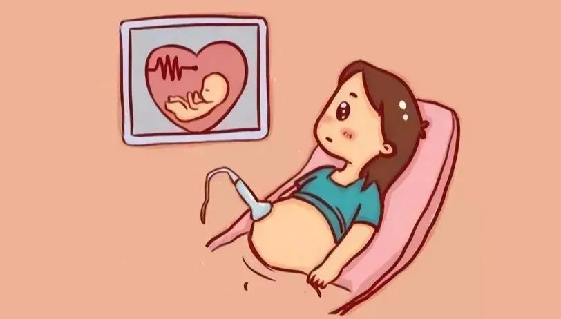 胎心180次是什么原因,胎心监护一胎动胎心就180