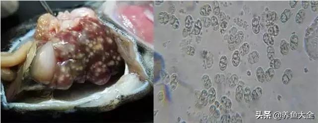 寄生虫多达6000条这种东西别乱吃,寄生虫的典型症状和表现