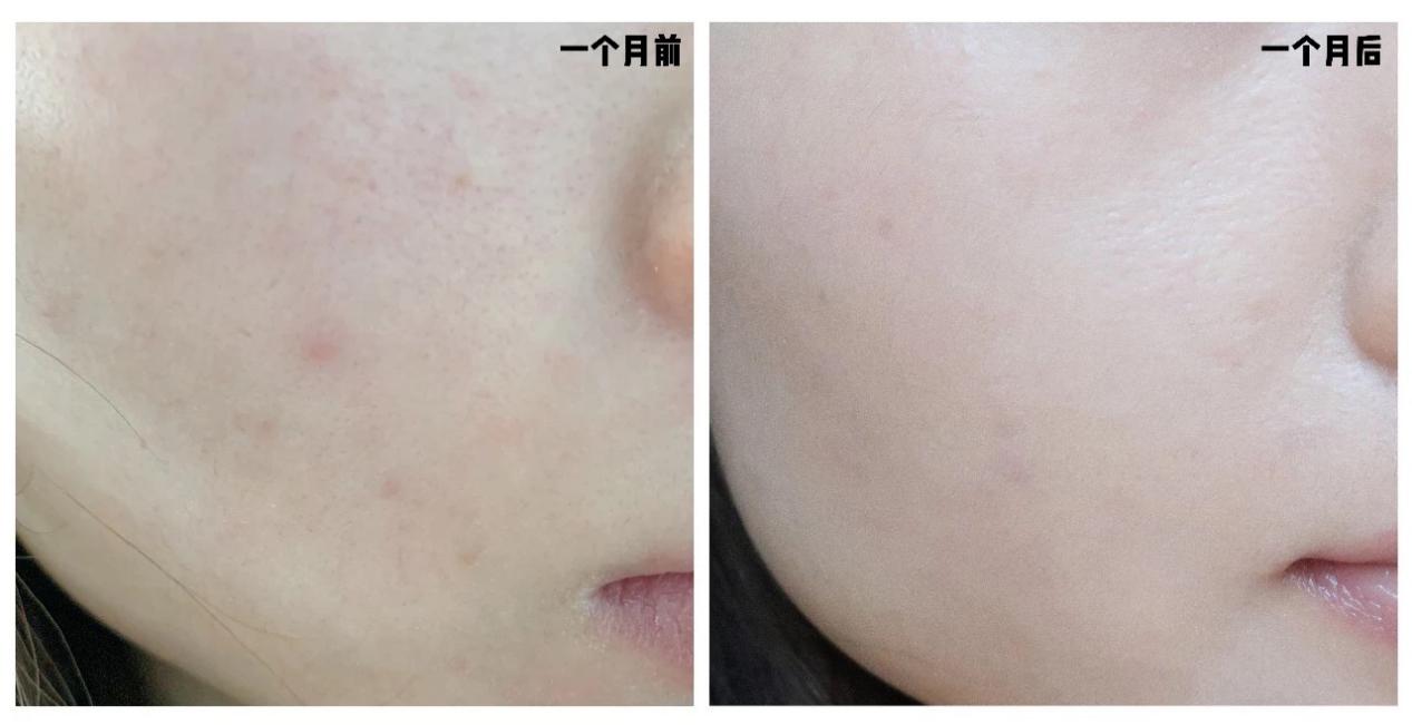 日本黑科技皮肤,日本黑科技产品去皱纹