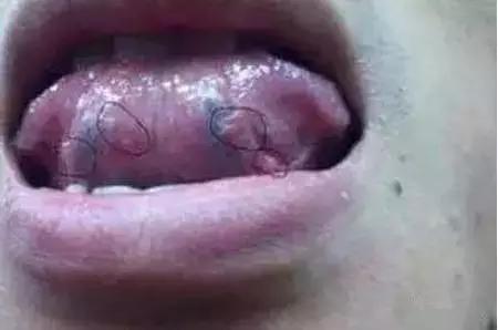 老中医提醒舌头4种异常,舌头一旦出现这个信号马上找中医