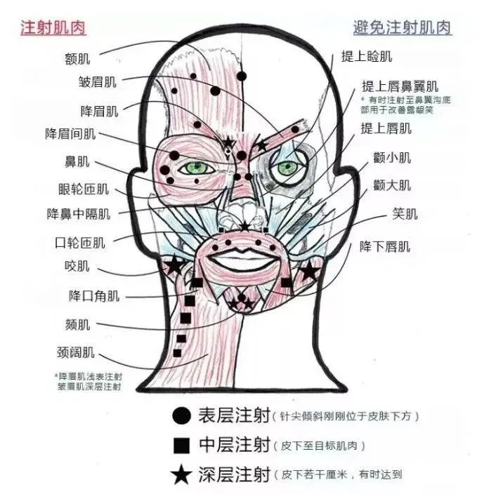 下颌线打瘦脸溶脂脖子变得僵硬了,打完瘦脸一边脸僵硬怎么办