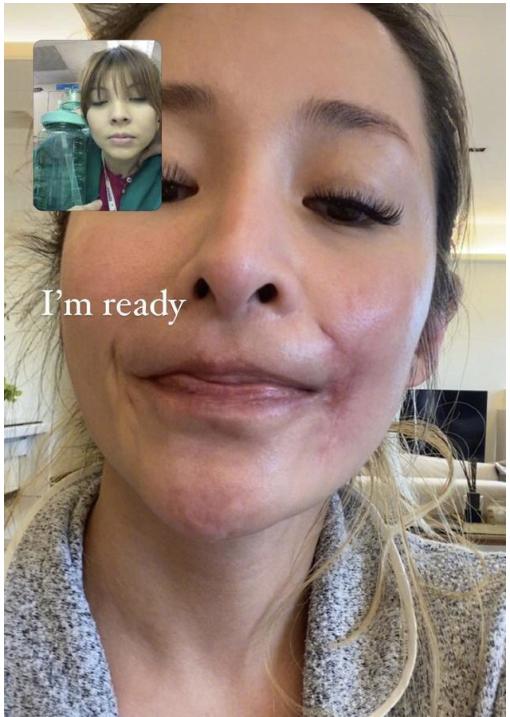 萧亚轩被狗咬伤能回到以前吗,萧亚轩被狗咬伤视频