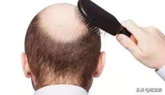 生娃是罐秃顶剂,从此我变成了裘千尺