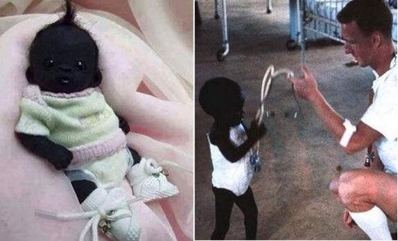 世界上最白的女孩和最黑的女孩,世界上最白的人和最黑的人图片