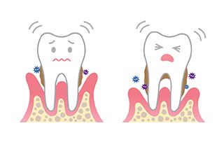 口腔医生容易得的病,口腔溃疡会引起牙齿萎缩吗