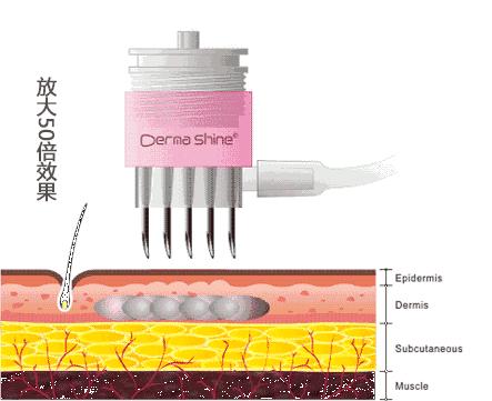 夏季告别油腻肌肤,夏日肌肤清爽指南