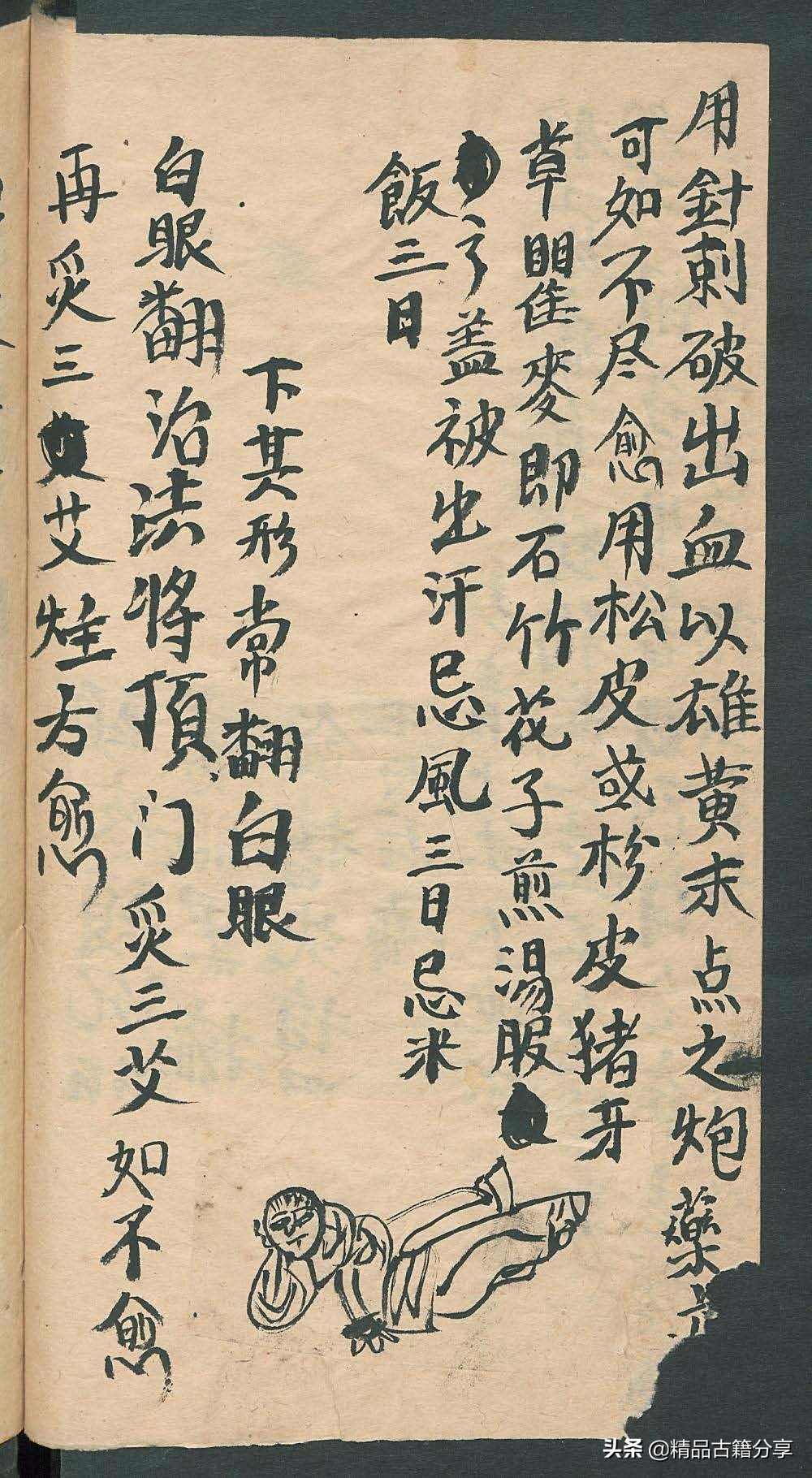 民间中医古籍书籍大全,民间看病书