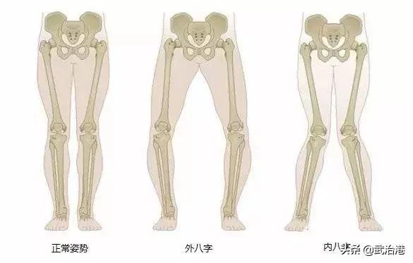 总是磨鞋底怎么办,总是磨鞋底是什么原因