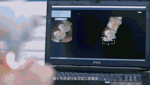 湖北种植牙齿多少钱一个,最新武汉种植牙齿多少钱一颗