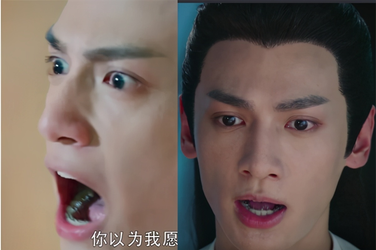 矫正牙齿选择什么托槽好,罗云熙牙齿矫正对比