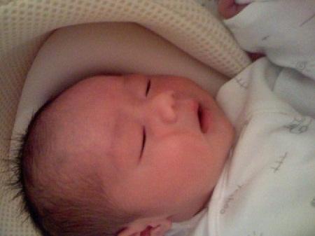 产钳助产会吓到宝宝吗,产钳助产对小孩有什么影响吗