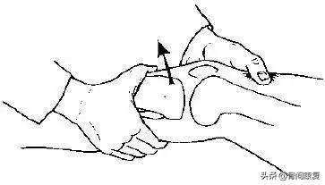 重建的交叉韧带一度松弛,韧带松弛重建后还会松弛吗