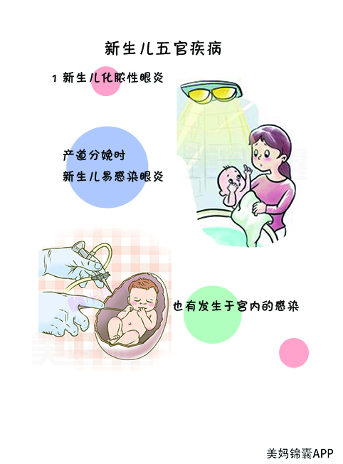 新生儿眼睛发炎怎么护理,新生儿眼睛化脓怎么办